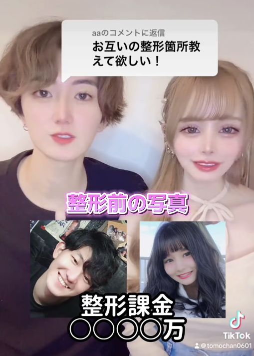 うんとも 整形前