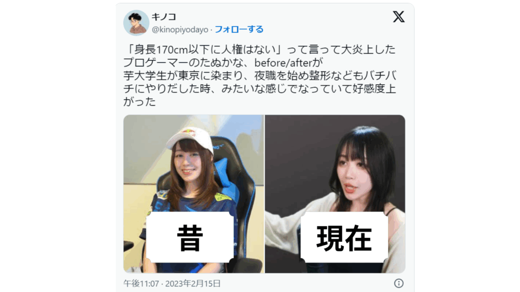 たぬかな 整形前